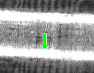 Injector Needle Damage
