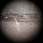 Needle Damage as Seen Under Microscope