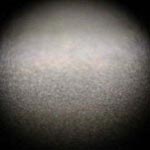 Needle Damage as Seen Under Microscope